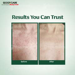 Baidyanath Goodcare Cold Pressed Neem Oil 100Ml